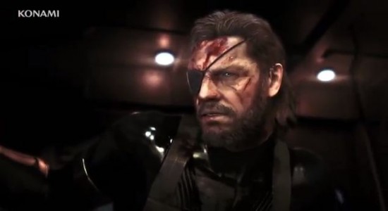 MGS5