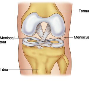 meniscus
