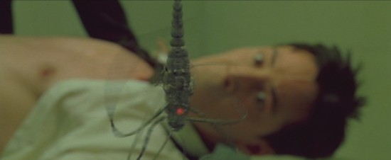 neoimplant